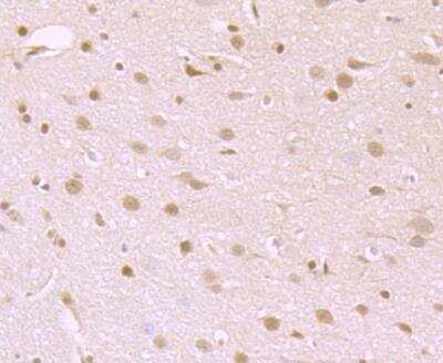 Immunohistochemistry-Paraffin: ATP Citrate Lyase Antibody [NBP3-09061] - Immunohistochemical analysis of paraffin-embedded rat brain tissue using anti-ATP citrate lyase antibody. Counter stained with hematoxylin.