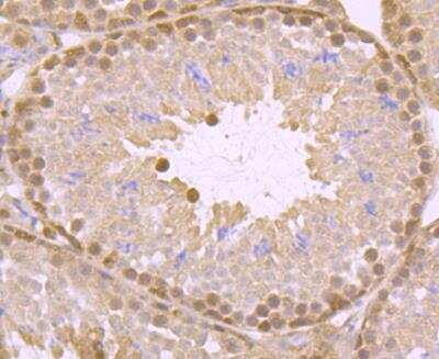 Immunohistochemistry-Paraffin: ATP Citrate Lyase Antibody [NBP3-09061] - Immunohistochemical analysis of paraffin-embedded mouse testis tissue using anti-ATP citrate lyase antibody. Counter stained with hematoxylin.