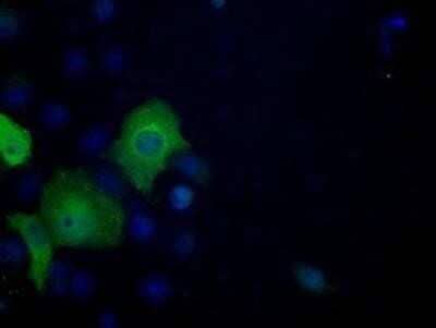Immunocytochemistry/Immunofluorescence: ATP Citrate Lyase Antibody (OTI3G8) - Azide and BSA Free [NBP2-70073] - Staining of COS7 cells transiently transfected by pCMV6-ENTRY ATP Citrate Lyase.