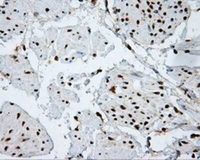 Immunohistochemistry: ATP Citrate Lyase Antibody (OTI3G8) - Azide and BSA Free [NBP2-70073] - Staining of paraffin-embedded bladder tissue using anti-ATP Citrate Lyase mouse monoclonal antibody.