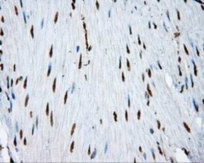 Immunohistochemistry: ATP Citrate Lyase Antibody (OTI3G8) - Azide and BSA Free [NBP2-70073] - Staining of paraffin-embedded colon tissue using anti-ATP Citrate Lyase mouse monoclonal antibody.