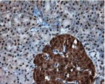 Immunohistochemistry: ATP Citrate Lyase Antibody (OTI3G8) - Azide and BSA Free [NBP2-70073] - Staining of paraffin-embedded pancreas tissue within the normal limits. Heat-induced epitope retrieval by 10mM citric buffer, pH6.0, 100C for 10min, Dilution 1:50.