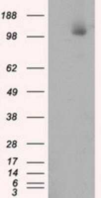 Western Blot: ATP Citrate Lyase Antibody (OTI3G8) - Azide and BSA Free [NBP2-70073] - HEK293T cells were transfected with the pCMV6-ENTRY control (Left lane) or pCMV6-ENTRY ATP Citrate Lyase (Right lane) cDNA for 48 hrs and lysed. Equivalent amounts of cell lysates (5 ug per lane) were separated by SDS-PAGE and immunoblotted with anti-ATP