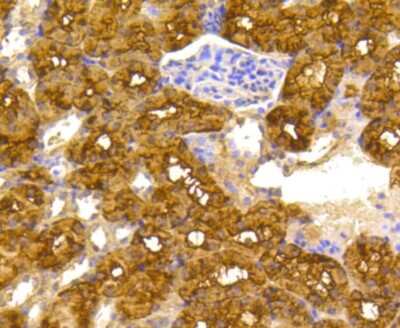 Immunohistochemistry-Paraffin: ATP Citrate Lyase Antibody (ST51-07) [NBP2-67509] - Analysis of mouse kidney tissue using anti-ATP citrate lyase antibody. Counter stained with hematoxylin.
