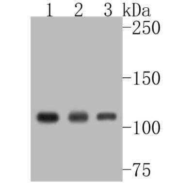 Western Blot: ATP Citrate Lyase Antibody (ST51-07) [NBP2-67509] - Analysis of ATP citrate lyase on different lysates. Proteins were transferred to a PVDF membrane and blocked with 5% BSA in PBS for 1 hour at room temperature. The primary antibody (1/500) was used in 5% BSA at room temperature for 2 hours. Goat Anti-Rabbit IgG - HRP Secondary Antibody at 1:5,000 dilution was used for 1 hour at room temperature. Positive control: Lane 1: A549 cell lysate Lane 2: CRC cell lysate Lane 3: Hela cell lysate