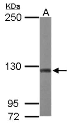 Western Blot: ATP Citrate Lyase Antibody [NBP1-33430] - Sample (50 ug of whole cell lysate) A: mouse brain 5% SDS PAGE, antibody diluted at 1:2000.