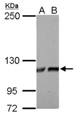 Western Blot: ATP Citrate Lyase Antibody [NBP1-33430] - A. 30 ug PC-12 whole cell lysate/extract, B. 30 ug Rat 2 whole cell lysate/extract 5% SDS-PAGE gel, antibody dilution 1:1000.