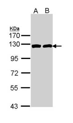 Western Blot: ATP Citrate Lyase Antibody [NBP1-33430] - Sample (30 ug of whole cell lysate) A: Hela B: Raji 7. 5% SDS PAGE; antibody diluted at 1:1000.