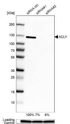 Western Blot: ATP Citrate Lyase Antibody [NBP1-90266] - Analysis in A-549 cells transfected with control siRNA, target specific siRNA probe #1 and #2, using Anti-ACLY antibody. Remaining relative intensity is presented. Loading control: Anti-GAPDH.