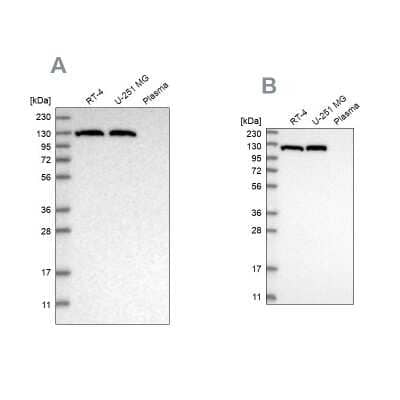 <b>Independent Antibodies Validation. </b>Western Blot: ATP Citrate Lyase Antibody [NBP1-90266] - Analysis using Anti-ACLY antibody NBP1-90266 (A) shows similar pattern to independent antibody NBP1-90268 (B).