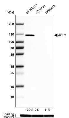 <b>Independent Antibodies Validation and Genetic Strategies Validation.</b>Western Blot: ATP Citrate Lyase Antibody [NBP1-90268] - Analysis in A-549 cells transfected with control siRNA, target specific siRNA probe #1 and #2, using Anti-ACLY antibody. Remaining relative intensity is presented. Loading control: Anti-GAPDH.