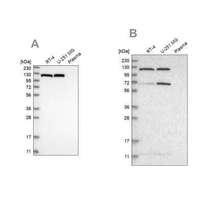 <b>Independent Antibodies Validation. </b>Western Blot: ATP Citrate Lyase Antibody [NBP1-90268] - Analysis using Anti-ACLY antibody NBP1-90268 (A) shows similar pattern to independent antibody NBP1-90267 (B).