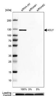 <b>Genetic Strategies Validation. </b>Western Blot: ATP Citrate Lyase Antibody [NBP1-90269] - Analysis in A-549 cells transfected with control siRNA, target specific siRNA probe #1 and #2, using Anti-ACLY antibody. Remaining relative intensity is presented. Loading control: Anti-GAPDH.