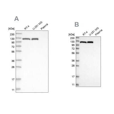 Western Blot: ATP Citrate Lyase Antibody [NBP1-90269] - Analysis using Anti-ACLY antibody NBP1-90269 (A) shows similar pattern to independent antibody NBP1-90268 (B).