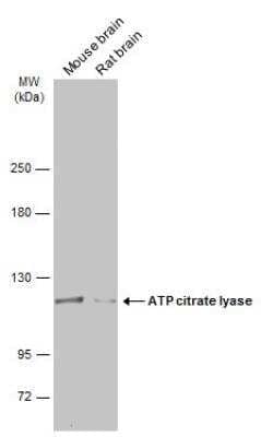 Western Blot: ATP Citrate Lyase Antibody [NBP2-15510] - Various tissue extracts (50 ug) were separated by 5% SDS-PAGE, and the membrane was blotted with ATP Citrate Lyase Antibody diluted at 1:5000. HRP-conjugated anti-rabbit IgG antibody was used to detect the primary antibody.