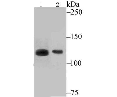 Western Blot: ATP Citrate Lyase Antibody [NBP3-09061] - Western blot analysis of ATP citrate lyase on mouse pancreas tissue (1) and NIH-3T3 cell (2) lysate using anti-ATP citrate lyase antibody at 1/200 dilution.