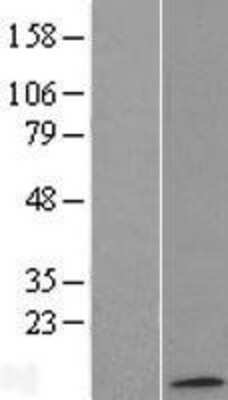 Western Blot ATP synthase C mature Overexpression Lysate