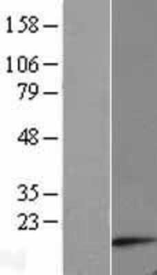 Western Blot ATP synthase C mature Overexpression Lysate