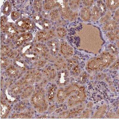 Immunohistochemistry ATP10A Antibody