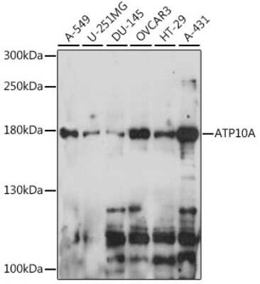 Western Blot ATP10A Antibody - Azide and BSA Free