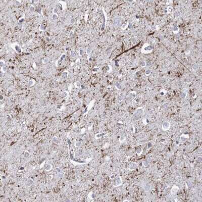 Immunohistochemistry-Paraffin: ATP10B Antibody [NBP1-90840] - Staining of human cerebral cortex shows strong positivity in neuronal processes.