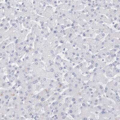 Immunohistochemistry-Paraffin: ATP10B Antibody [NBP1-90840] - Staining of human liver shows no positivity in hepatocytes as expected.