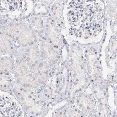 Immunohistochemistry-Paraffin: ATP10B Antibody [NBP1-90840] - Staining of human kidney shows no positivity in cells in tubules as expected.