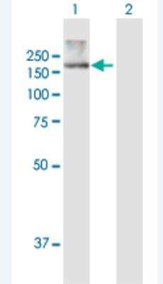 Western Blot ATP10B Antibody