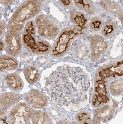 Immunohistochemistry-Paraffin: ATP11A Antibody [NBP1-88903] - Staining of human kidney shows moderate to strong positivity in apical membrane in cells in tubules.