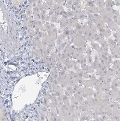 Immunohistochemistry-Paraffin: ATP11A Antibody [NBP1-88903] - Staining of human liver shows no positivity in hepatocytes as expected.