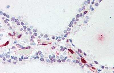 Immunohistochemistry-Paraffin ATP13A1 Antibody