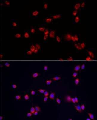 Immunocytochemistry/Immunofluorescence: ATP13A2 Antibody [NBP2-92104] - Analysis of NIH/3T3 cells using ATP13A2 Rabbit pAb at dilution of 1:50 (40x lens). Blue: DAPI for nuclear staining.