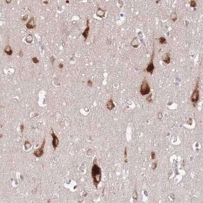 Immunohistochemistry: ATP13A2 Antibody [NBP2-48985] - Staining of human cerebral cortex shows strong cytoplasmic positivity in neuronal cells.