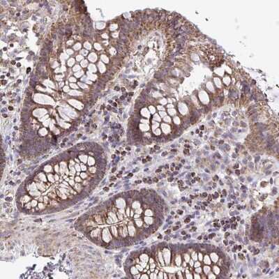 Immunohistochemistry ATP13A2 Antibody