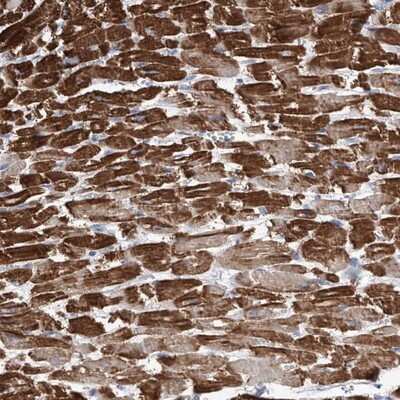 Immunohistochemistry-Paraffin: ATP13A3 Antibody [NBP1-90867] - Staining of human heart muscle shows strong cytoplasmic positivity.