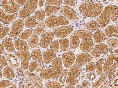 Immunohistochemistry-Paraffin ATP13A3 Antibody - BSA Free