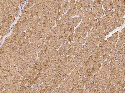 Immunohistochemistry-Paraffin ATP13A3 Antibody - BSA Free
