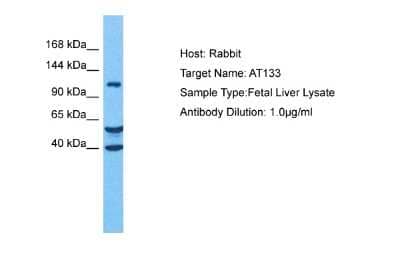Western Blot ATP13A3 Antibody - BSA Free