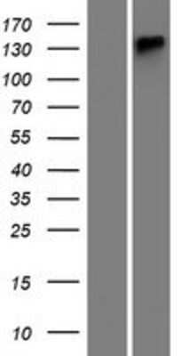 Western Blot: ATP13A4 Overexpression Lysate (Adult Normal) [NBP2-06049] Left-Empty vector transfected control cell lysate (HEK293 cell lysate); Right -Over-expression Lysate for ATP13A4.