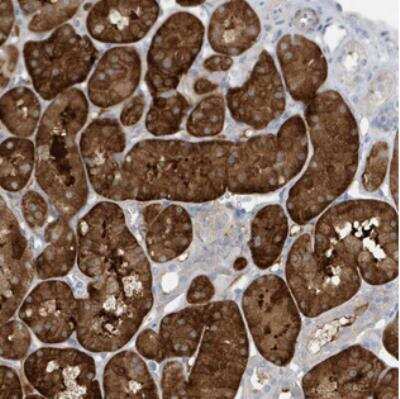 Immunohistochemistry-Paraffin ATP13A5 Antibody - BSA Free