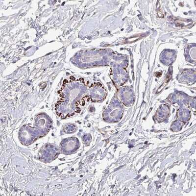 Immunohistochemistry-Paraffin: ATP2C2 Antibody [NBP2-14329] Staining of human breast shows strong cytoplasmic positivity in myoepithelial cells.