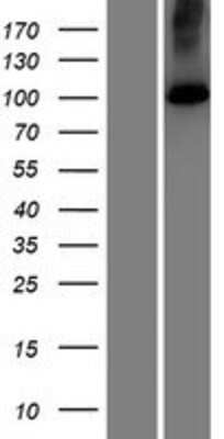 Western Blot: ATP2C2 Overexpression Lysate (Adult Normal) [NBP2-07263] Left-Empty vector transfected control cell lysate (HEK293 cell lysate); Right -Over-expression Lysate for ATP2C2.