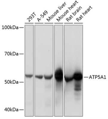 Western Blot: ATP5A Antibody (6M3B8) [NBP3-15355] - Analysis of extracts of various cell lines, using ATP5A Rabbit mAb (NBP3-15355) at 1:1000 dilution. Secondary antibody: HRP Goat Anti-Rabbit IgG (H+L) at 1:10000 dilution. Lysates/proteins: 25ug per lane. Blocking buffer: 3% nonfat dry milk in TBST. Detection: ECL Basic Kit. Exposure time: 1s.