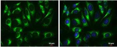 Immunocytochemistry/Immunofluorescence: ATP5A Antibody [NBP2-15512] - HeLa cells were fixed in 4% paraformaldehyde at RT for 15 min. Green: ATP5A1 protein stained by ATP5A1 antibody [C2C3], C-term diluted at 1:500. Blue: Hoechst 33342 staining. Scale bar = 10 um.