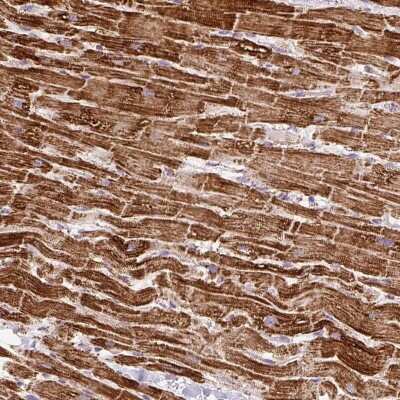 Immunohistochemistry: ATP5A Antibody [NBP2-38525] - Staining of human heart muscle shows strong cytoplasmic positivity in myocytes.