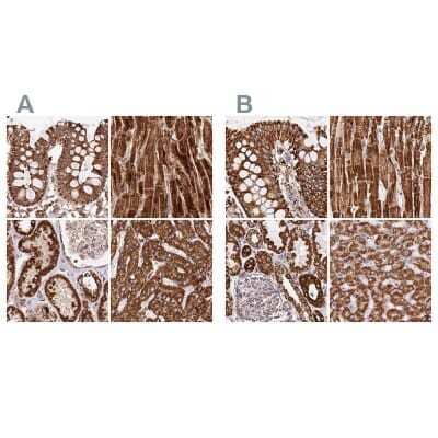 <b>Independent Antibodies Validation. </b>Immunohistochemistry-Paraffin: ATP5A Antibody [NBP2-38470] - Staining of human colon, heart muscle, kidney and liver using Anti-ATP5A1 antibody NBP2-38470 (A) shows similar protein distribution across tissues to independent antibody NBP2-38525 (B).