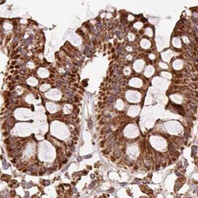 <b>Independent Antibodies Validation. </b>Immunohistochemistry-Paraffin: ATP5A Antibody [NBP2-38470] - Staining of human colon.