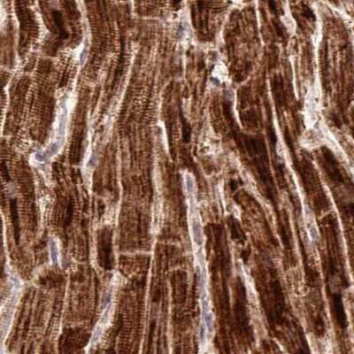 Immunohistochemistry-Paraffin: ATP5A Antibody [NBP2-38470] - Staining of human heart muscle.