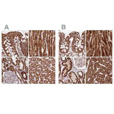 <b>Independent Antibodies Validation. </b>Immunohistochemistry-Paraffin: ATP5A Antibody [NBP2-38525] - Staining of human colon, heart muscle, kidney and liver using Anti-ATP5A1 antibody NBP2-38525 (A) shows similar protein distribution across tissues to independent antibody NBP2-38470 (B).