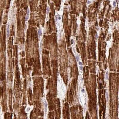 Immunohistochemistry-Paraffin: ATP5A Antibody [NBP2-38525] - Staining of human heart muscle.